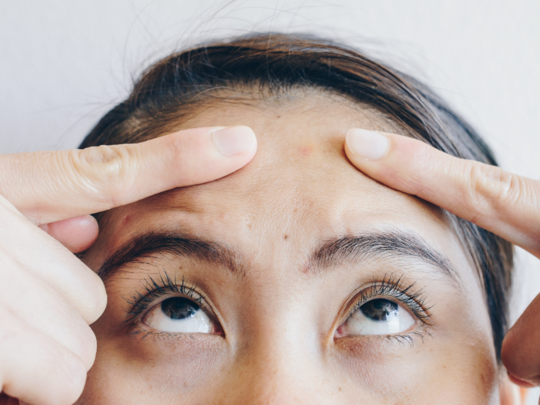 tips to treat the acne on forehead : माथे पर हो गए हैं पिंपल, तो दूर करने के लिए अपनाएं ये 4 तरीके